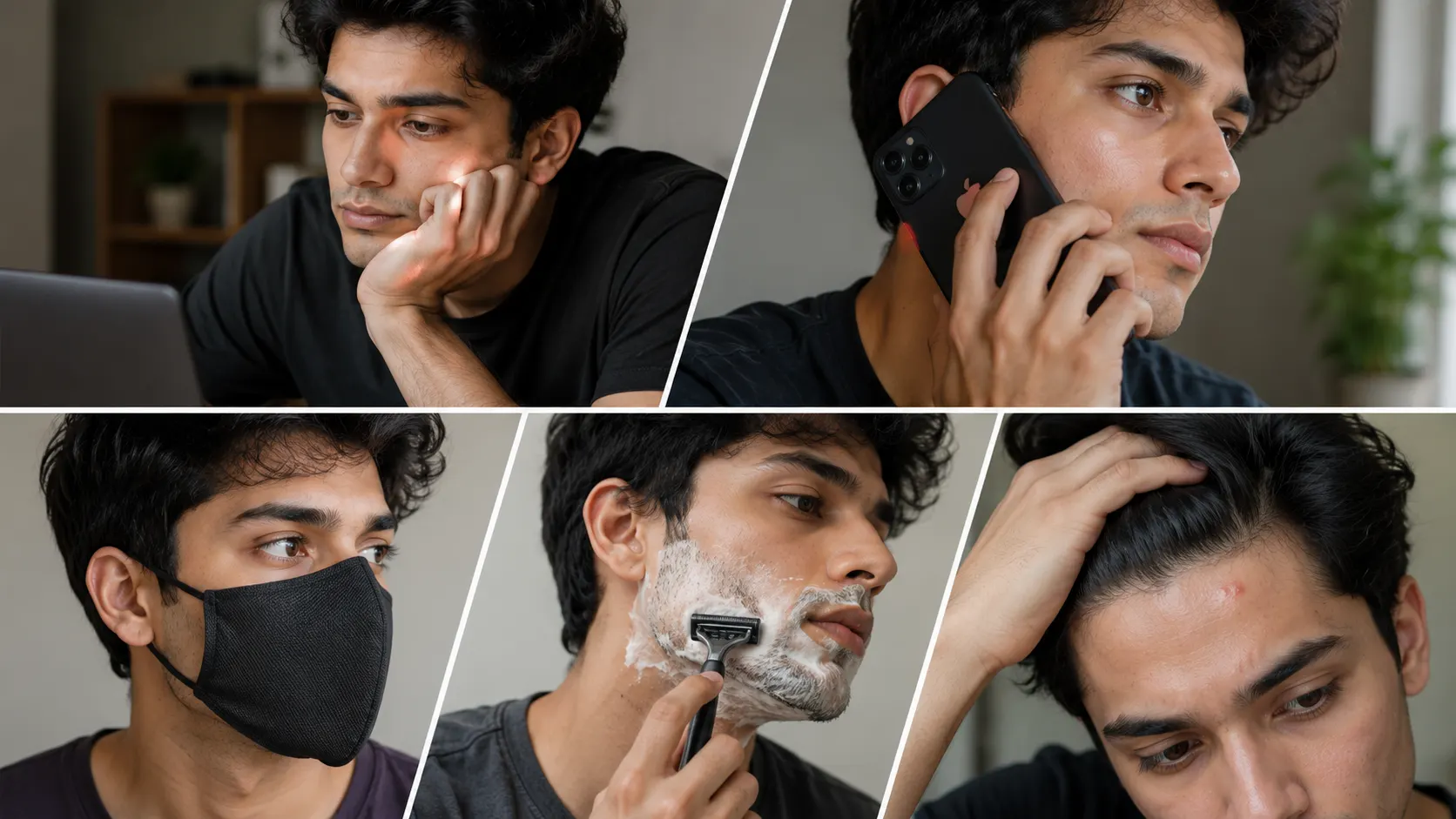 Treat the Area, Not Only the Visible Pimple