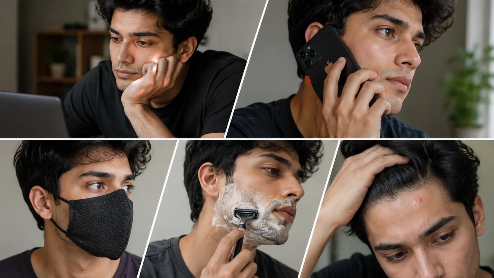 Treat the Area, Not Only the Visible Pimple